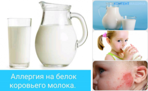 Аллергия на белок коровьего молока у детей и методы её лечения